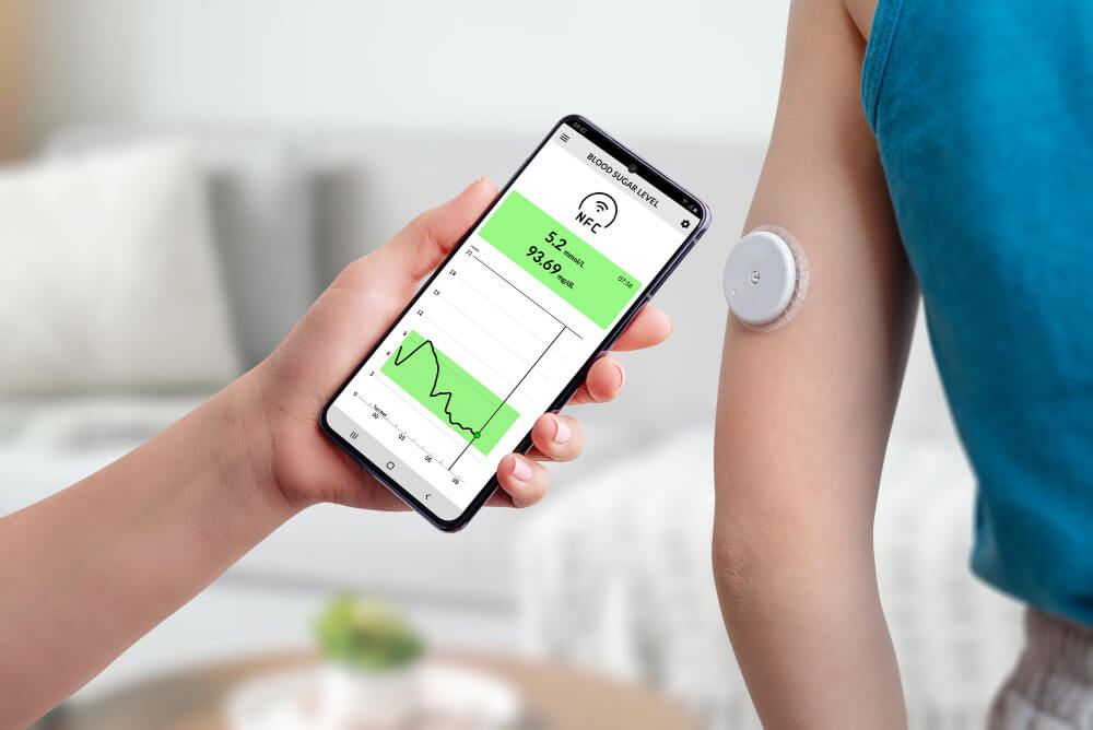 KI-gestützter Fitnesstracker